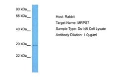 MRPS7 Antibody, Novus Biologicals 100 &mu;L; Unconjugated:Antibodies, Polyclonal